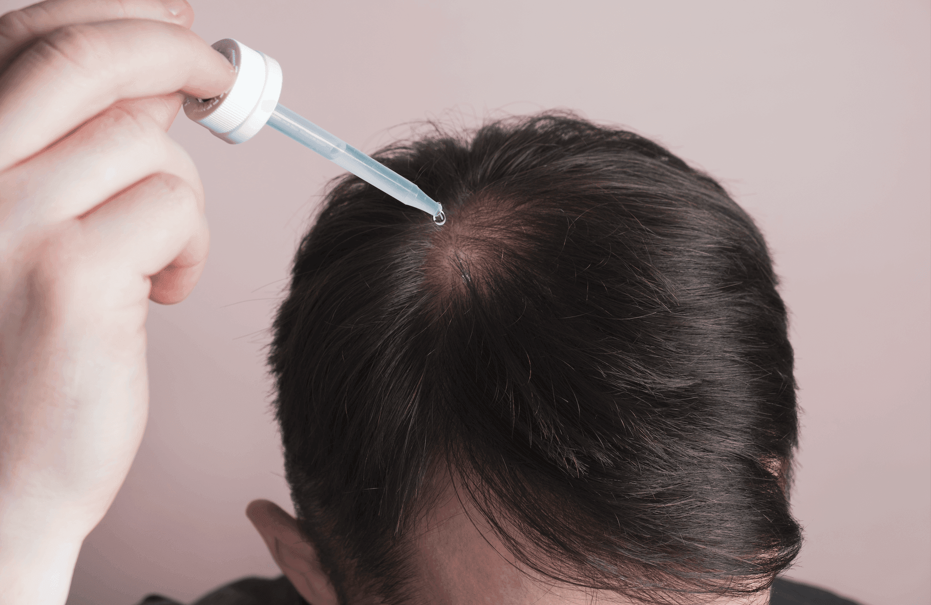 Marek Hair Loss Topical-image